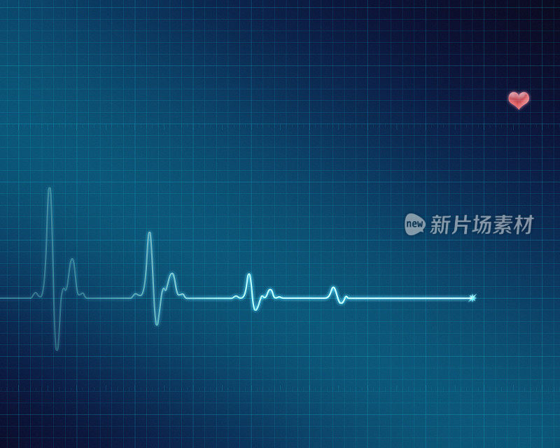 心电图(ECG/EKG)平线筛查